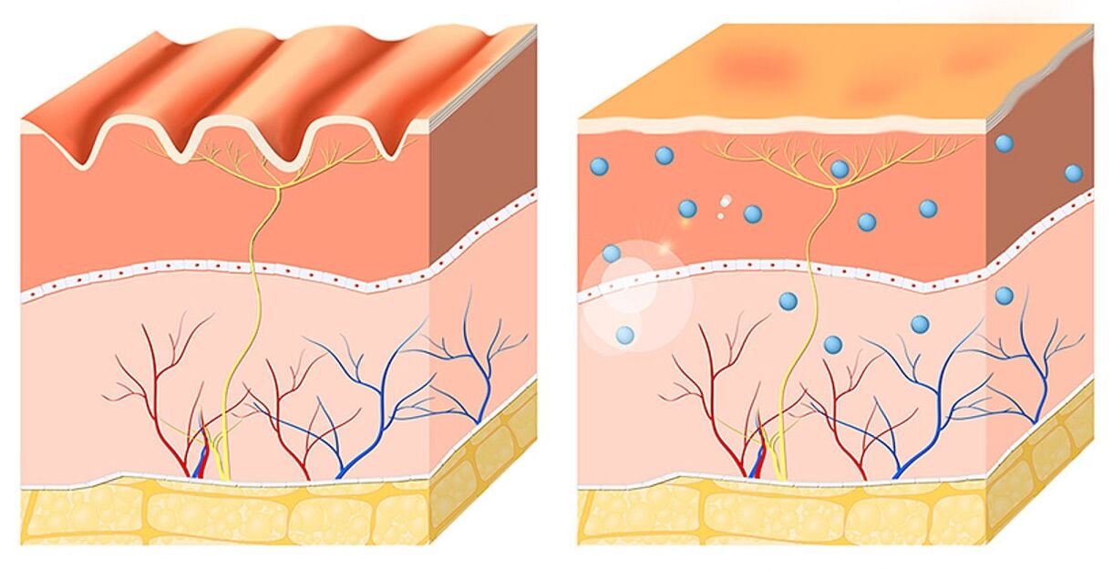 Inno Gialuron smooths and moisturizes the epidermis