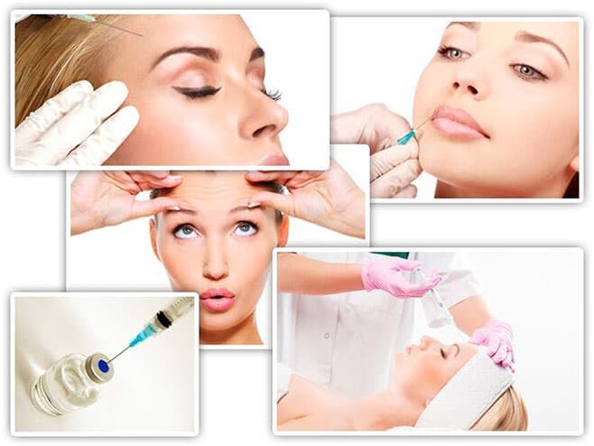 Injections for facial rejuvenation