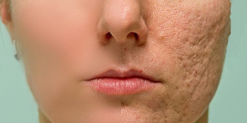 Indications for the rejuvenation process