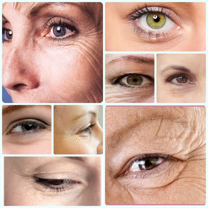 Rejuvenation of the skin