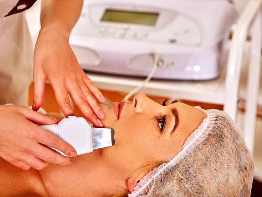 Ultrasound face peeling
