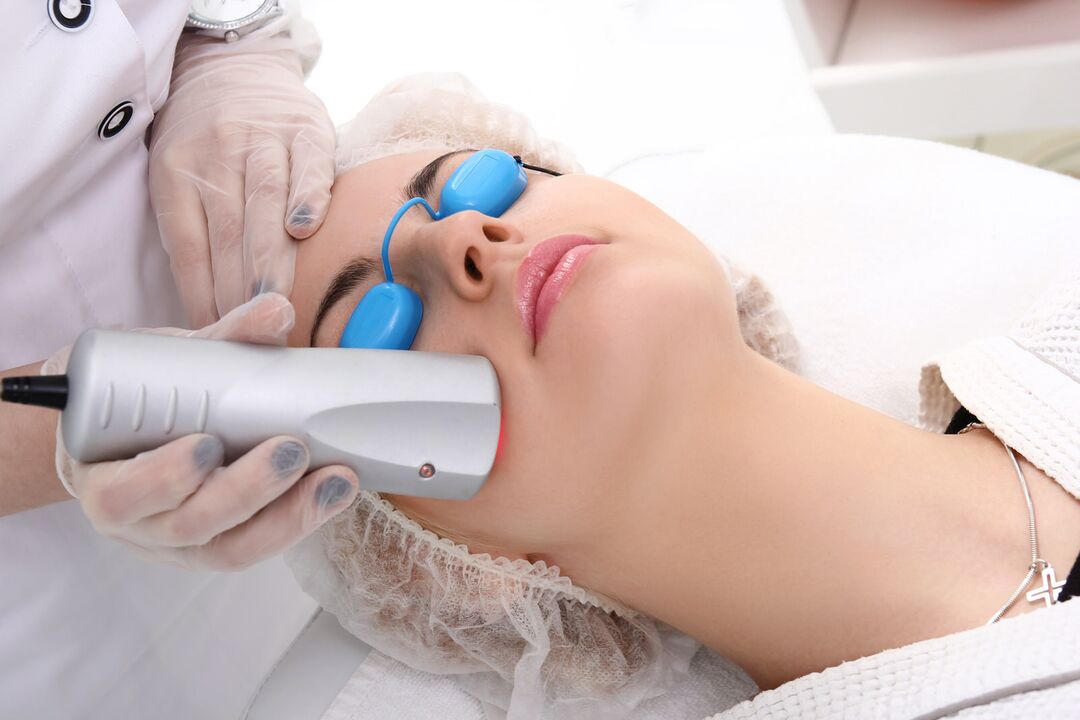 Laser Skin Rejuvenation