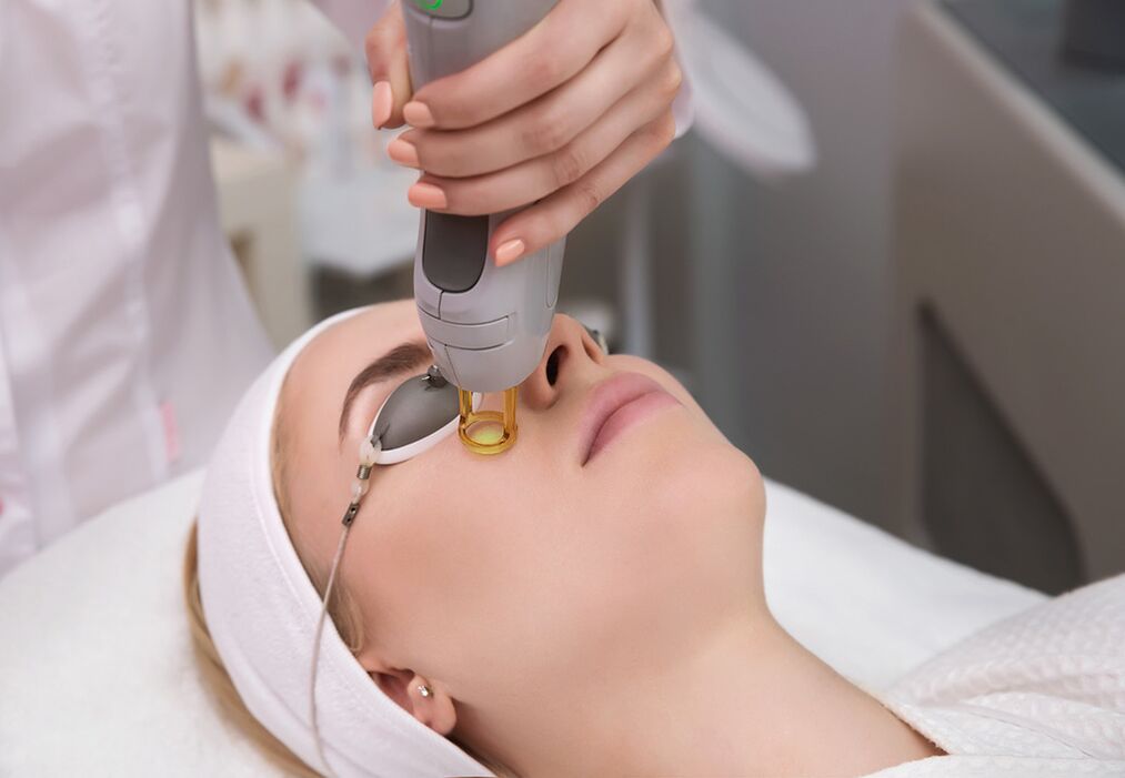How is laser rejuvenation of the skin around the eyes performed