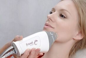 the essence of the procedure for fractional facial skin rejuvenation