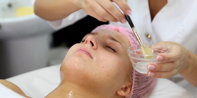 A woman undergoes a peeling