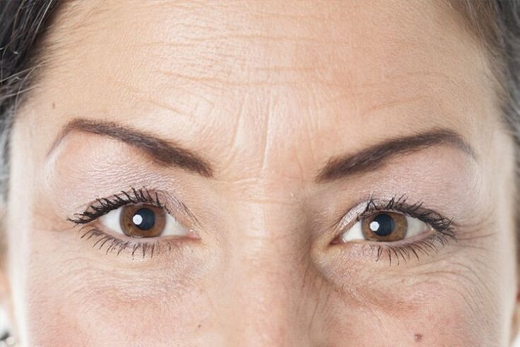 Causes of skin aging on the face