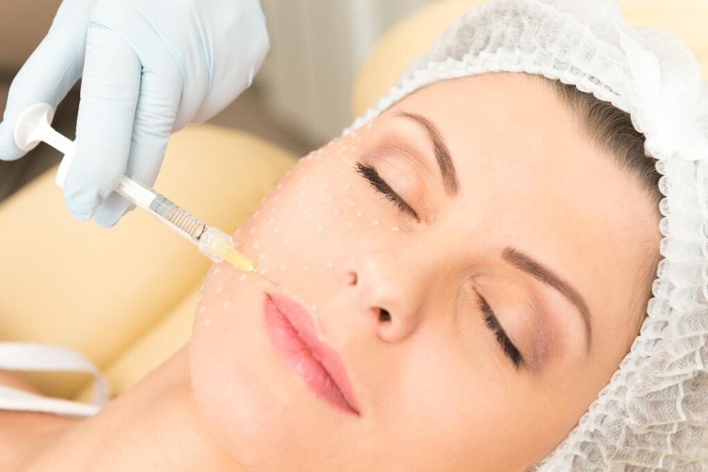 Mesotherapy for facial rejuvenation